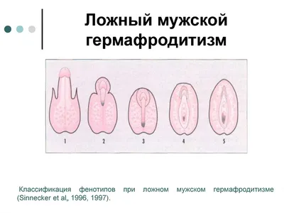 Фото гермафродитов: Ваш выбор - стиль и формат