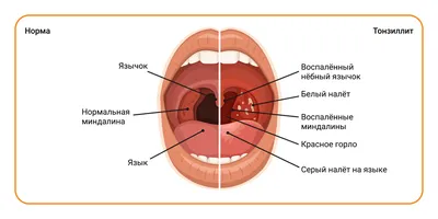 Гланды человека: Скачивание фото в различных форматах