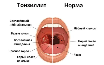 Исследуйте анатомию: Фото гланд с выбором формата