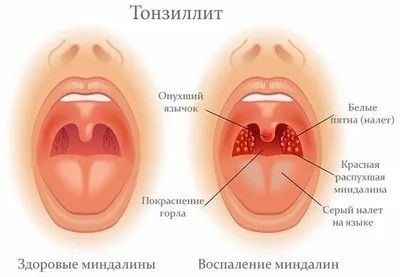 Фото гланд человека: Выберите размер и формат для скачивания