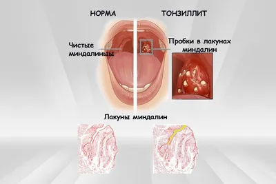 Фотографии гланд: Разнообразие размеров и форматов для скачивания