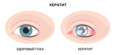 1. Разнообразие глазных болезней человека