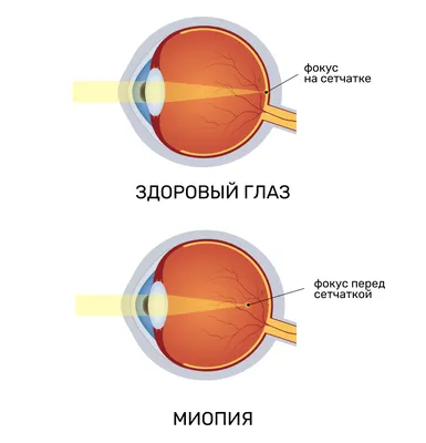 12. Фотографии глазных болезней: скачивай в высоком качестве