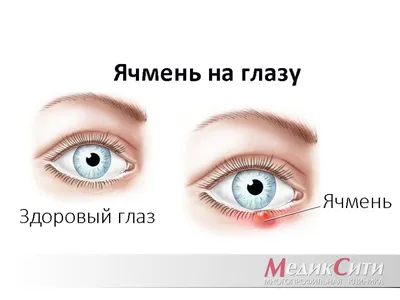 19. Подробное изучение глазных заболеваний: JPG, PNG, WebP