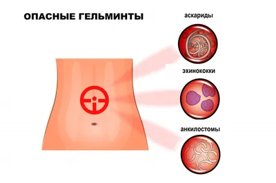 Изучаем человеческий мир: Глисты в кале на экране