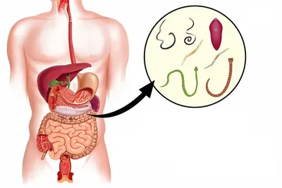 Редкие изображения Глистов у Человека: PNG