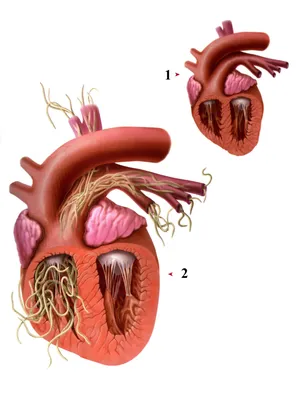 Глисты в сердце человека: Великолепные изображения в высоком разрешении