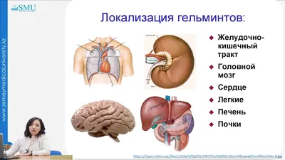 Изображение человеческого сердца с глистами: Подбирайте размер под ваши потребности