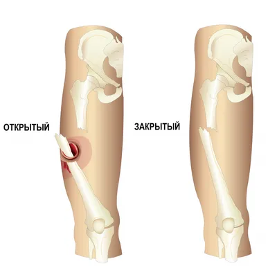 Голень человека в различных размерах и форматах