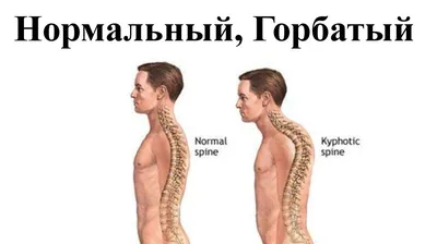 Фотографии Горбатого человека: выбирайте изображение по своему вкусу!