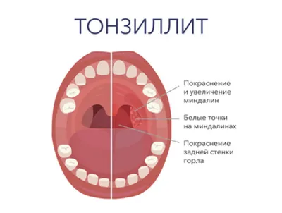 Человеческое Горло: Фото и Изображения в Различных Форматах