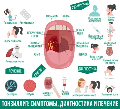 Изображения Человеческого Горла: Скачивание JPG, PNG, WebP