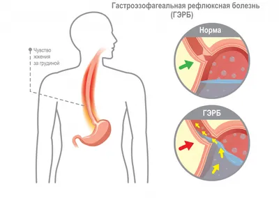 Человеческое Горло: Фото и Изображения в Различных Форматах