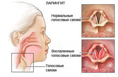 Горло человека в разных форматах: фото для скачивания