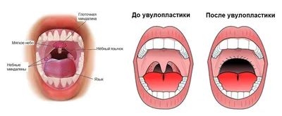 Эмоциональная глубина: фотографии человеческого горла