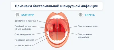 Фотографии здорового горла: идеальное сочетание форматов