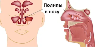 Подробные изображения горла: выберите свой стиль