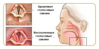 Эстетика здорового горла: лучшие изображения в различных размерах