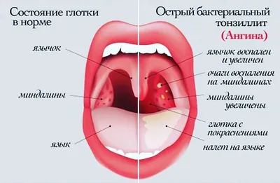 Фотографии горла: откройте для себя красоту в каждом пикселе