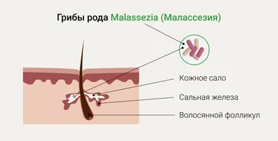 Изображение грибка на теле человека: Скачать в разных форматах