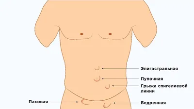 16. Галерея грыж: Размеры и форматы изображений