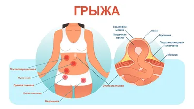 36. Визуализация проблемы: Фотографии грыж в разрешении