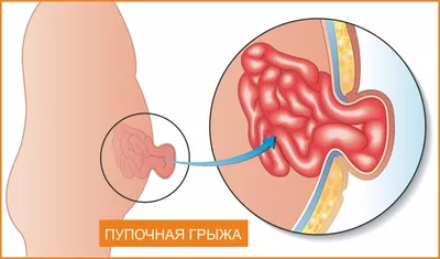 8. Фотографии анатомии: Размеры и форматы изображений