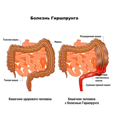 Интерактивная Анатомия: Фотографии Кишечника с Опциями