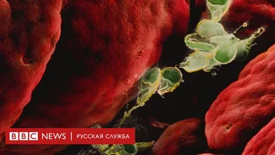 Фото, картинка, изображение: Кишечные паразиты в деталях