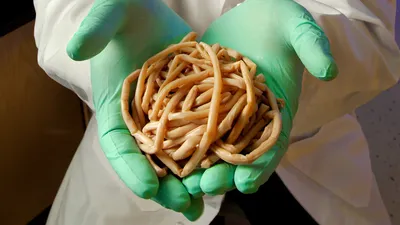 Уникальные изображения человеческих кишечных паразитов