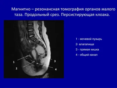 Изображение клоаки у человека: JPG, PNG, WebP