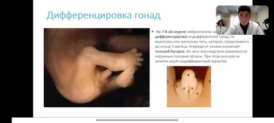 Фото человеческой клоаки: Размеры изображения