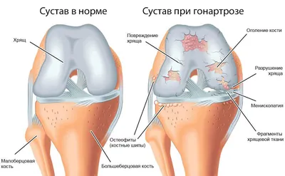 Эстетика колен: скачайте красивые фото в JPG