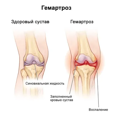 Фотографии колен человека: выбор формата и размера