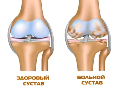 Фотка коленного сустава - выбор размера изображения