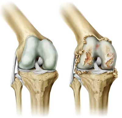 Фото коленного сустава человека - JPG для высокой четкости