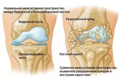 Фотография коленного сустава: выбор формата для скачивания