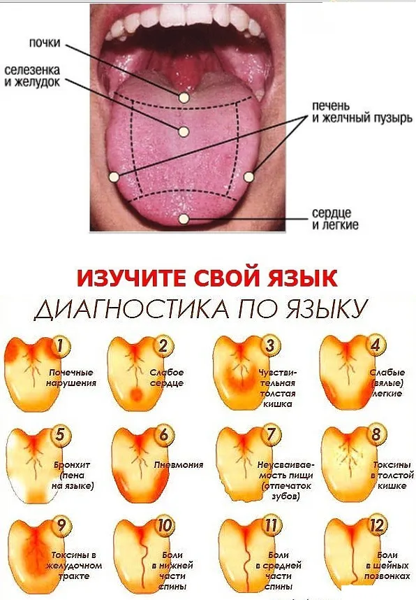 Красные пятна на языке: причины и лечение