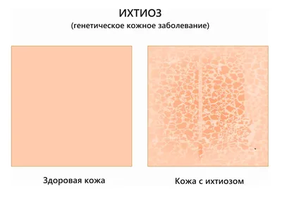 Фотографии Различных Кожных Заболеваний в Отличном Качестве