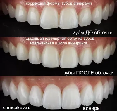 Фотография с красивыми зубами в формате WebP на разных размерах