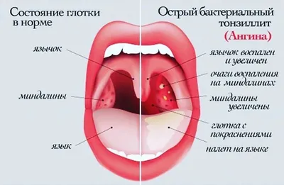 Красное горло картинки: красные картинки для вашего проекта