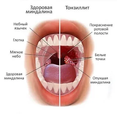 Фотографии красного горла: удивительные краски на фото