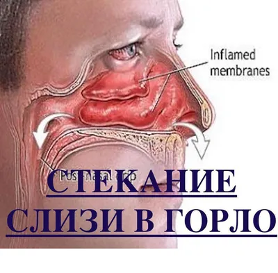 Красное горло у ребенка: новые изображения для скачивания в хорошем качестве