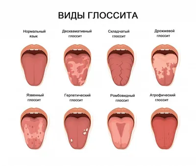 Красное горло у ребенка: впечатляющие кадры