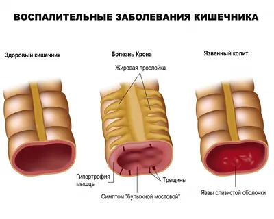 Реалистичные изображения крови в кале: выберите размер и скачайте JPG, PNG или WebP