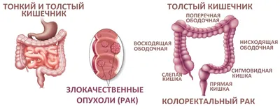 Уникальные изображения крови в кале: выбирайте JPG, PNG или WebP для скачивания