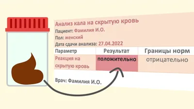 Привлекательные изображения крови в кале человека: выберите JPG, PNG или WebP