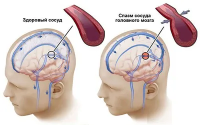 Фото здоровых легких: PNG для оптимизации веба