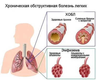 Удовольствие от просмотра: Лёгкие курящего человека в различных размерах