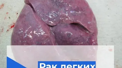 Уникальные ракурсы: Лёгкие курящего человека в разных форматах